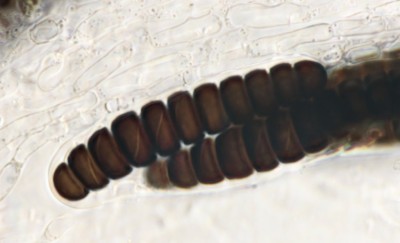 Sporormiella bw (3).jpg