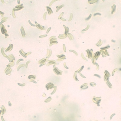 Diatrypella favacea H2O_1000_1.jpg
