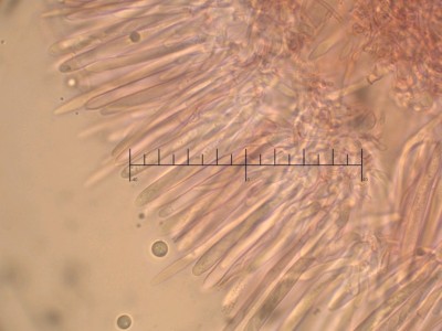 Lachnum brevipilosum asci cr.jpg