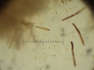 Lachnum brevipilosum sporen_Lugol.jpg