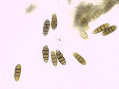 Lophiostoma compressum sporen_H2O_1000_1_1.jpg