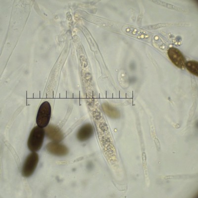 Paraxylaria xylostei asci.jpg