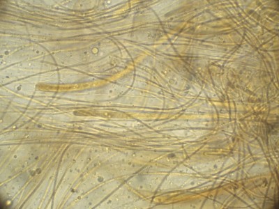 Robergea cubicularis Lugol_1000_1_2--.jpg