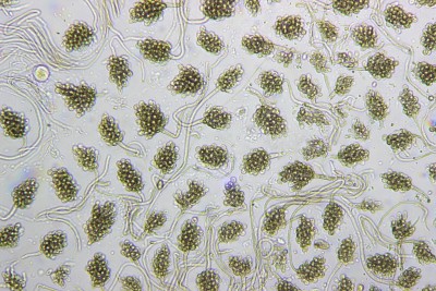 Cheirospora botryospora - Traubensporiger Handsporling