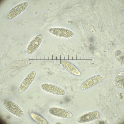 Pseudomassaria chondrospora sporen.jpg