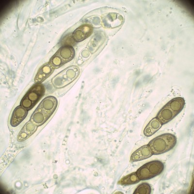 Splanchospora ampullacea H2O_1000_3.jpg