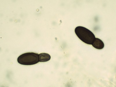 Splanchospora ampullacea Lugol_1000_2.jpg