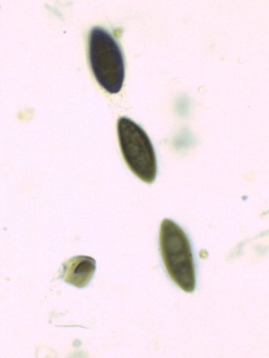 Hypoxylon vogesiacum #H2O_1000_2.jpg