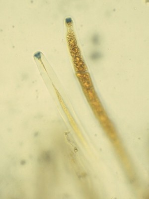 Hypoxylon vogesiacum Lugol_1000_3.jpg