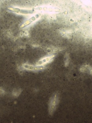 Setoseptoria arundinacea Sporen Ink_1000.jpg