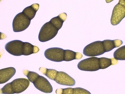 Asteromassaria macrospora H2O_1000.jpg