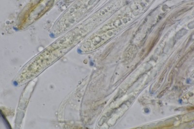 Thuemenidium atropurpureum mikr  (8).JPG