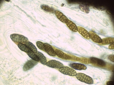 04 Murispora rubicunda Lugol_1000_6.jpg