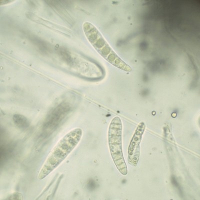 03 Patellaria atrata.jpg