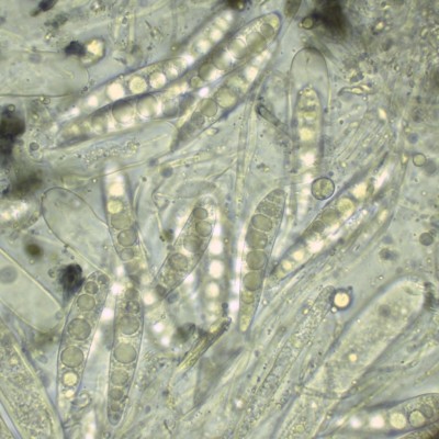 04 Patellaria atrata.jpg