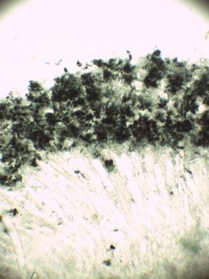 05 Patellaria atrata.jpg