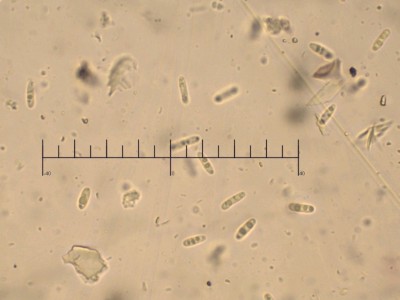 06 Nitschkia grevillei Kongo 1000x ©Andreas Millinger.jpg