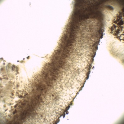 03 Sclerococcum stygium H2O_400.jpg
