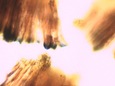 04 Sclerococcum stygium Lugol_1000_3.jpg