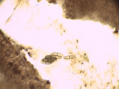 05 Sclerococcum stygium H2O_1000__.jpg