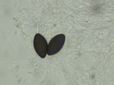 03 Schizothecium tetrasporum H2O_1000_6.jpg