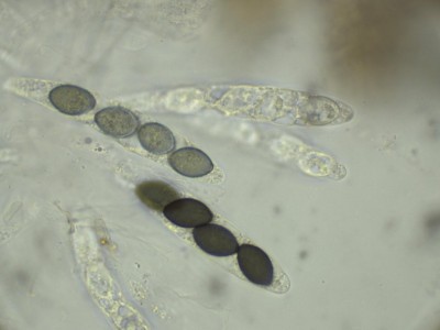 01 Schizothecium tetrasporum H2O_1000.jpg