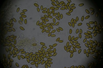 Bild Sporen 1000x.jpg