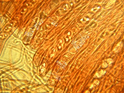 Asci 12,0-12,4µ