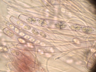 03 Tarzetta cupularis sporenmasse im ascus.jpg