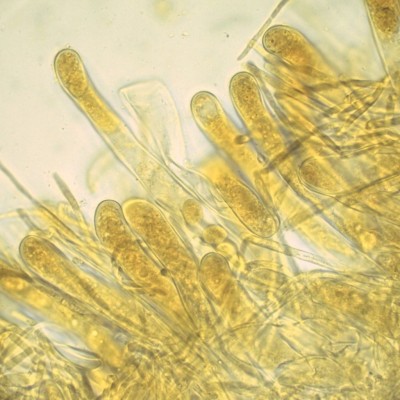 04 Tarzetta cupularis Lugol_1000_1.jpg