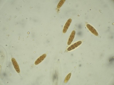 06 Calosporella innesii Lugol_1000_2.jpg