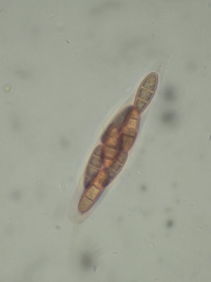 08 Calosporella innesii CR_1000_9.jpg