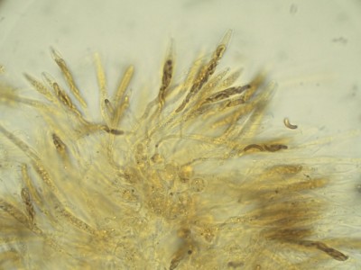 02 Diatrype decorticata Lugol_1000_6.jpg