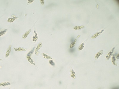 05 Peroneutypa scoparia H2O_1000_1.jpg