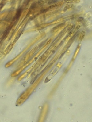 02 Pyrenopeziza petiolaris ascus Pyrenopeziza petiolaris.jpg