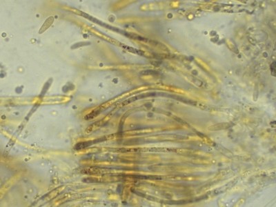03 Pyrenopeziza petiolaris Paraphysen Lugol_1000_4.jpg
