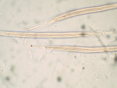 03 Linospora saligna CR_1000_4.jpg