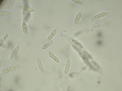 04 Melanconis alni H2O_1000_1.jpg