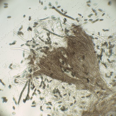 03 Phaeocalicium compressulum H2O_400.jpg