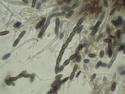 04 Phaeocalicium compressulum H2O_1000_3.jpg