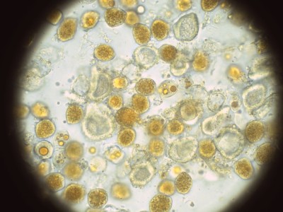03 Aecidium euphorbiae agg H2O_1000.jpg