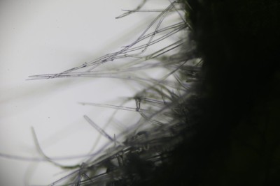 Cecidophyes nudus hyaline Haare an Geum urbanum (8).JPG