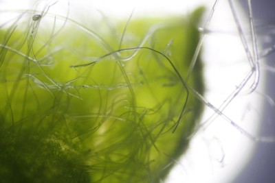 Cecidophyes nudus hyaline Haare an Geum urbanum (14).JPG