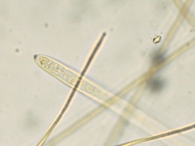 03 Vibrissea decolorans Lugol_1000_2.jpg
