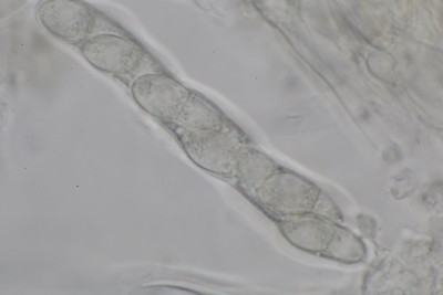 Ramularia rubella mikr (7).JPG