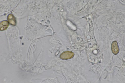 Inocybe ochroalba mikr (5).JPG