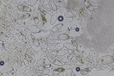 Inocybe ochroalba mikr 400-f (1).JPG