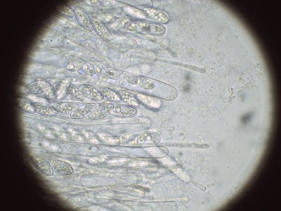 Trichophaea gregaria H2O_1000_2.jpg