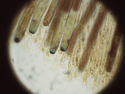 05 Peziza granularis  Lugol_1000_1.jpg