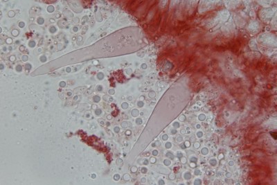 Mycena galopus Zystiden (2).JPG